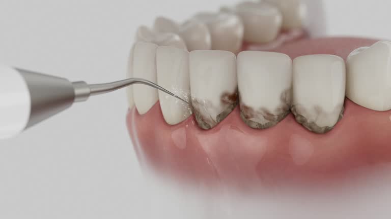 Trusted Teeth Cleaning And Checkup service in South Milwaukee, WI - Dentist Open Now